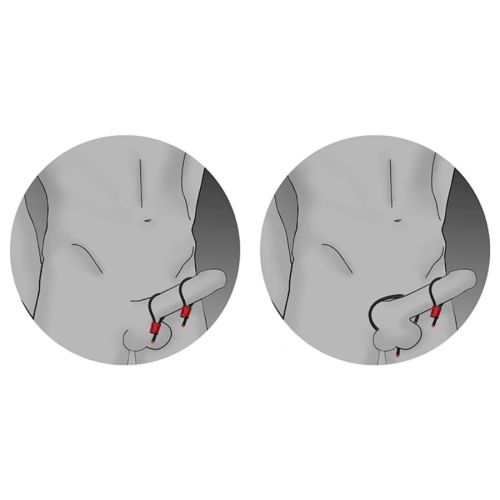 ELECTRASTIM – AN?IS PENIANOS AJUST?VEIS PRESTIGE ELECTRA LOOPS PRETOS